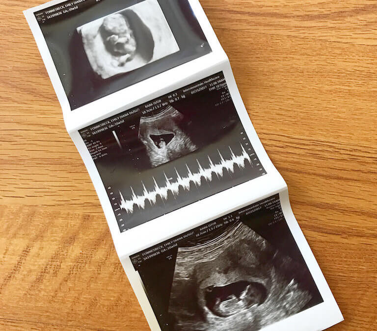 We’re Having a Baby! + a few thoughts on infertility